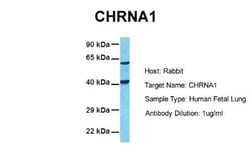 Nicotinic Acetylcholine R alpha 1/CHRNA1 Rabbit anti-Human, Polyclonal, Novus Biologicals 0.1 mL | Buy Online | Novus Biologicals | Fisher Scientific